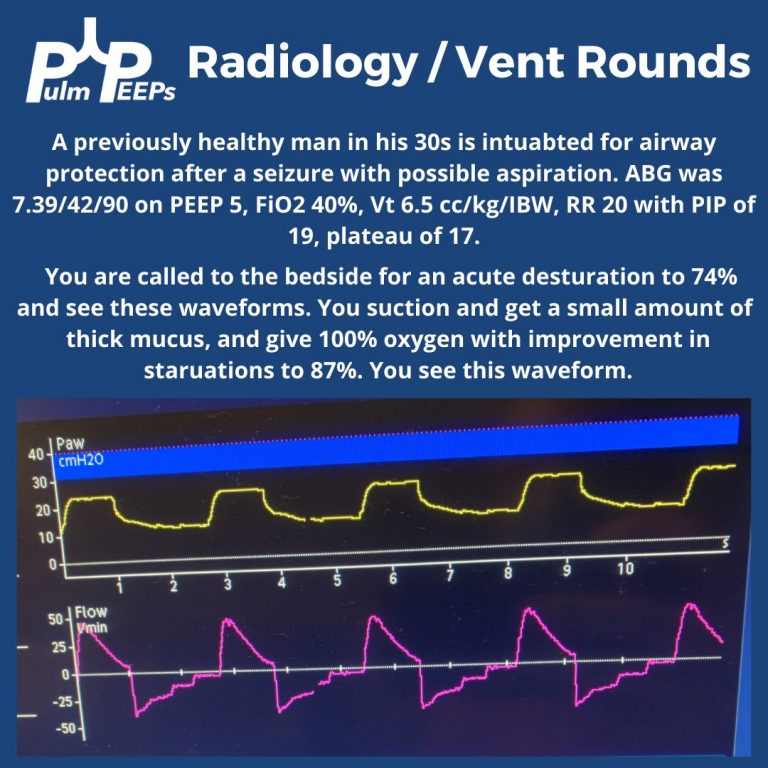 Radiology Rounds – 1/31/23 | PulmPEEPs