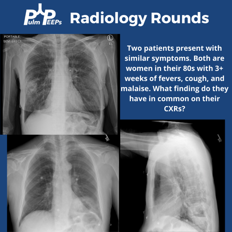 Radiology Rounds – 9/5/23 | PulmPEEPs